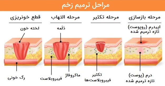 process-of-healing-wound